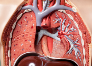 Pulmonary Embolism Treatment