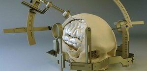 Stereotactic Surgery