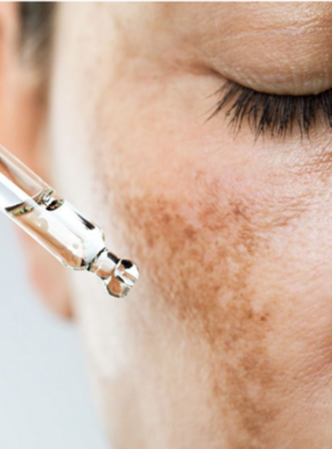 Pigmentation Solution