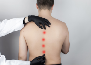 Spinal Deformity Correction | Dr. Shrikant Dalal