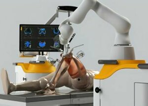 Robotic Knee Replacement surgery