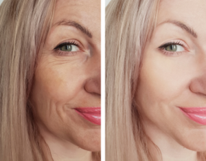 Jaw Surgery and Facial Reconstruction: How Oral and Maxillofacial Surgeons Can Help|Dr. Vishal Tapadiya