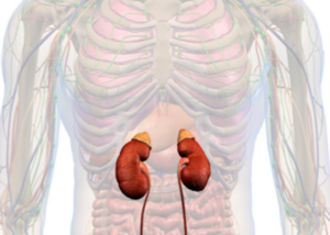 Adrenal Disorders