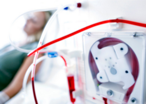 Hemodialysis