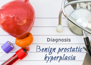 Prostate :TURP LASER &amp;TUIP, Endoscopic Removal of Prostate