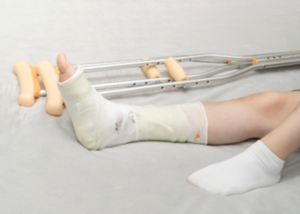 Fractures &amp; Accident