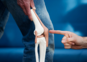 Joint Replacement Surgery
