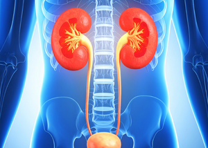 Bladder stone removal