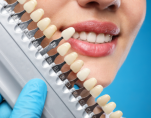 Cosmetic Dentistry