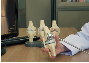 Knee Replacement Surgery