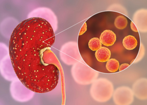 Recurrent Urinary Infections Prevention|Dr. Veena Chaudhari