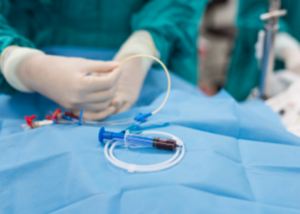 Tunelled Cuff Catheter Insertion