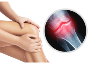 Joint Pain - Sushrut Hospital