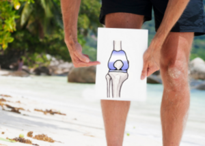 Total knee replacement