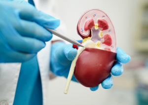 Pelvi-Ureteric Junction Obstruction (PUJO)