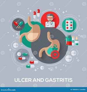 Peptic Ulcer Treatment