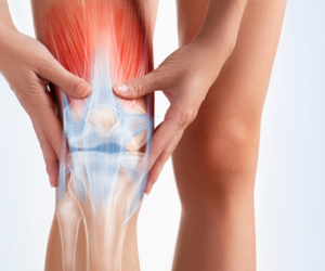 Total Knee Replacement (TKR)