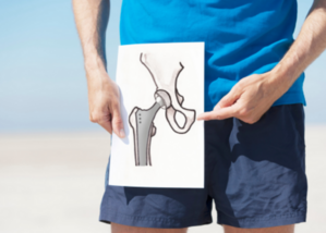 Total Hip Replacement (THR)