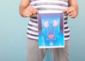 Urological Cancer Treatment