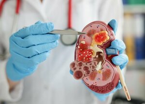 Urologic Cancer Surgery