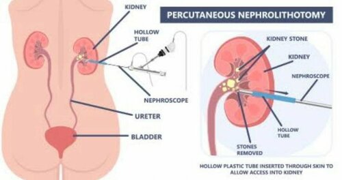 Urozoone Holistic Kidney Care Clinic|Viman Nagar,Pune