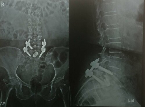 Dr. Soman's Skin and Spine Clinic|Karvenagar,Pune