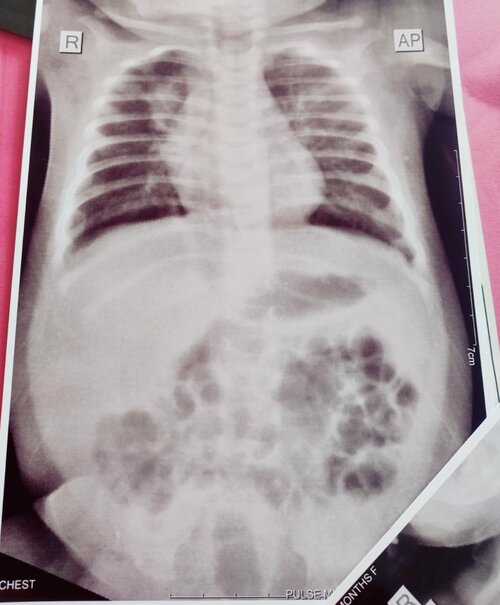 Pulse Multispeciality Hospital|Navale Bridge,Pune