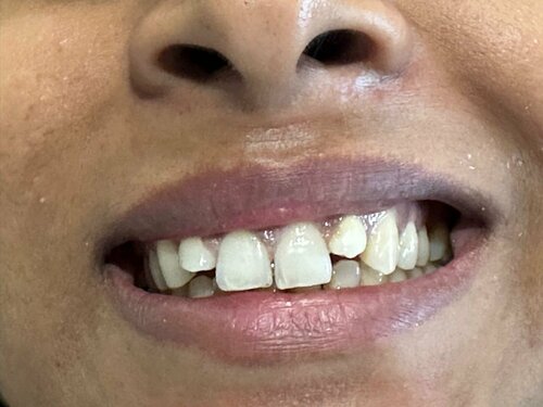 Phadke's Vitality Dental Clinic|Karve Nagar,Pune