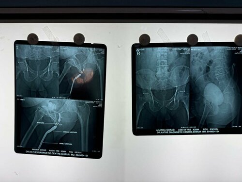 Urozoone Holistic Kidney Care Clinic|Viman Nagar,Pune