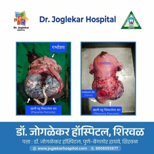 Dr. Joglekar Hospital and Fertility Centre|Khandala,Satara