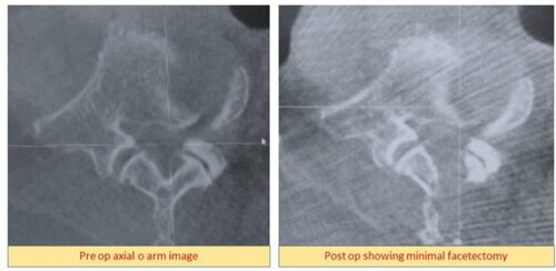 Dr. Ajay Kothari - Spine Surgeon|Shivaji Nagar,Pune