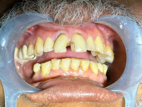 Phadke's Vitality Dental Clinic|Karve Nagar,Pune