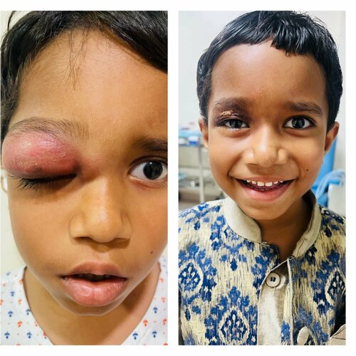 Dr Bhagat's ENT endoscopy clinic|Hadapsar,Pune