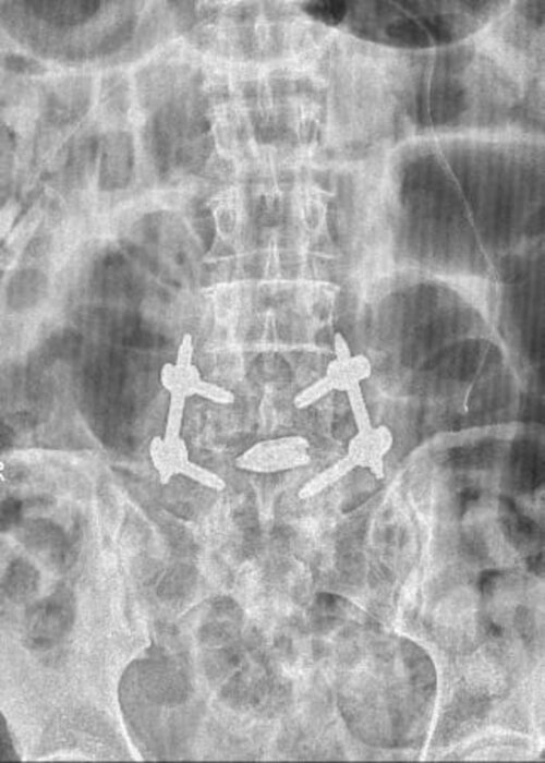 Dr. Soman's Skin and Spine Clinic|Karvenagar,Pune