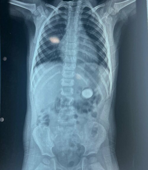 Pulse Multispeciality Hospital|Navale Bridge,Pune