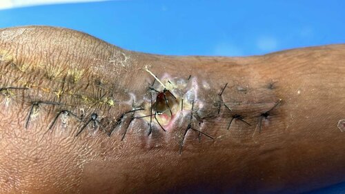 Dr. Preeti S. Ajapuje's Center for Infectious Disease|Koregaon Park,Pune