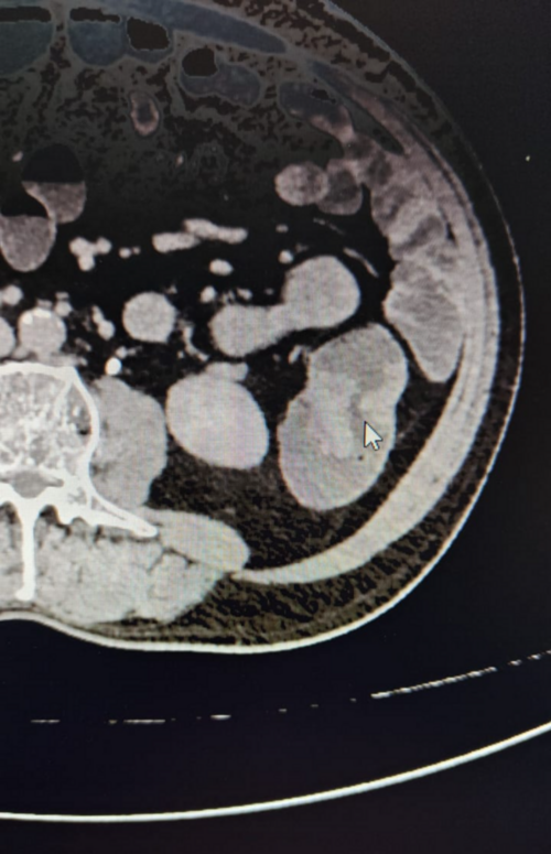 Liver and Pancreas clinic|Baner,Pune