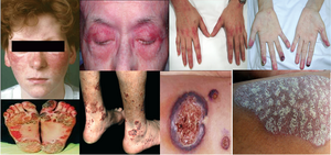 Arthritis | Dr. Sauvik Dasgupta