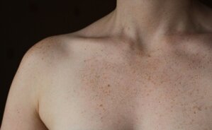 Body Pigmentation
