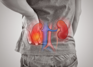Acute Kidney Injury