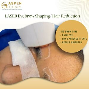Laser Eyebrow Hair Reduction and Laser Eyebrow Shaping | Dr. Hina Khan