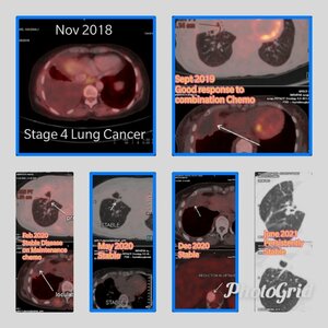 Maintenance Therapy in Cancer Treatment