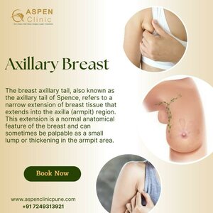 Breast Axillary Tail - Dr. Hina Khan