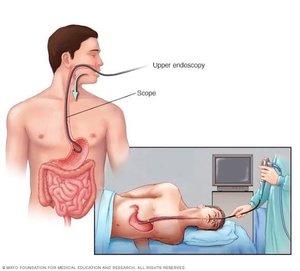 Endoscopy and Its types | Dr. Varun Khandagale