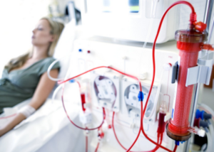 Hemodialysis |Dr. Maheiish Rokade