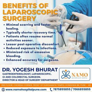 Benefits of Laparoscopic Surgery