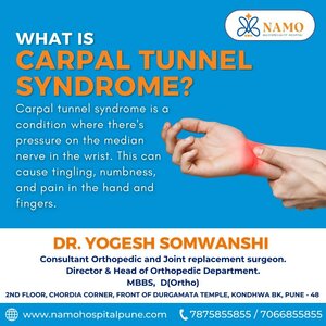 What is Carpal Tunnel Syndrome?