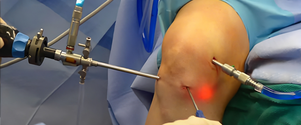 Arihant Ortho & Trauma Center - banner photos