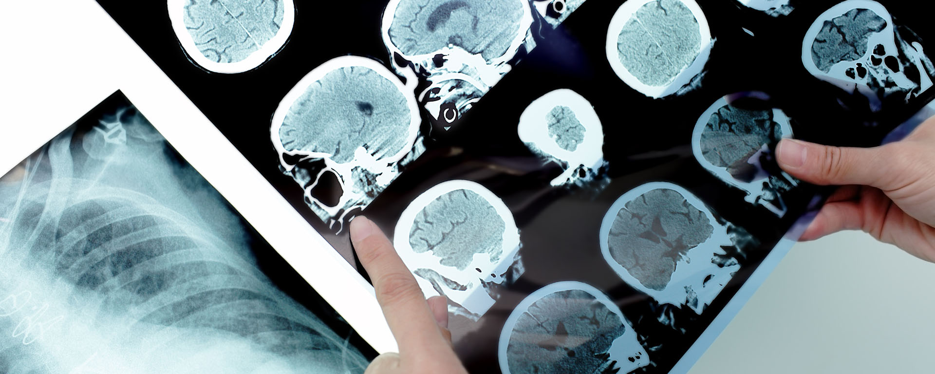 Banner of Dr. Shingare's Paralysis & Neurocare Center