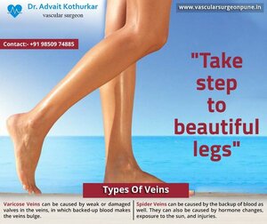 Take step to beautiful Legs !!